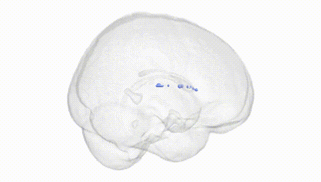 Full Brain White