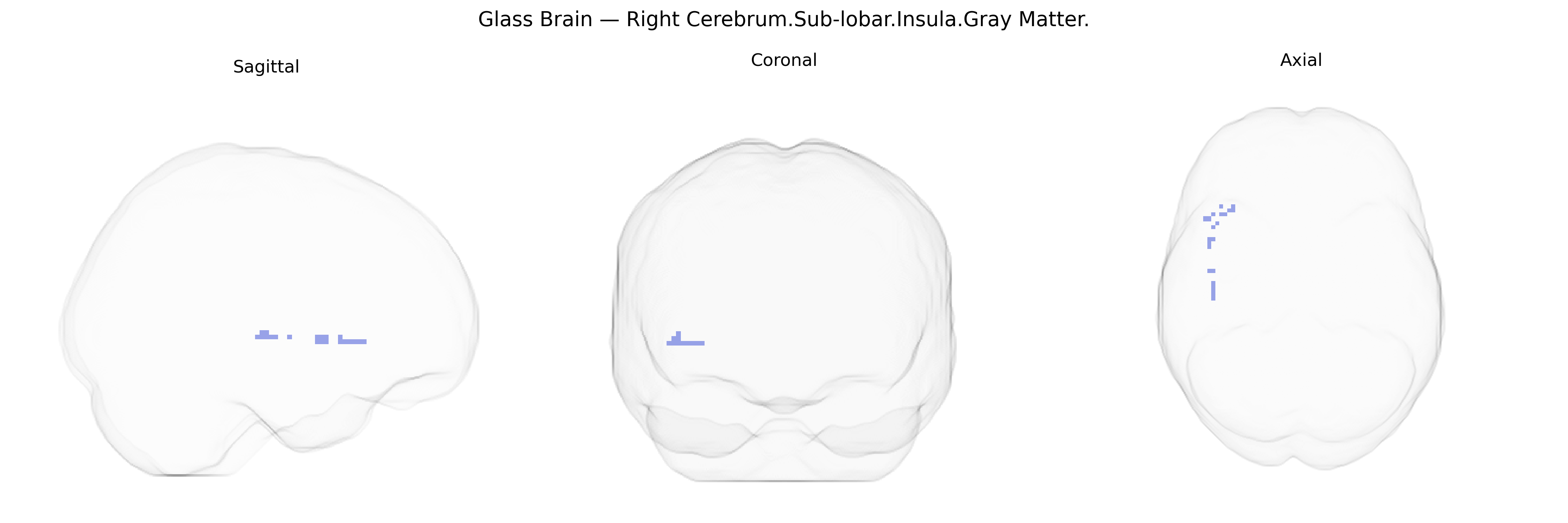 Triplanar Ghost Brain