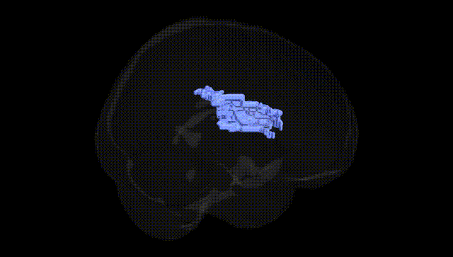 Full Brain Black