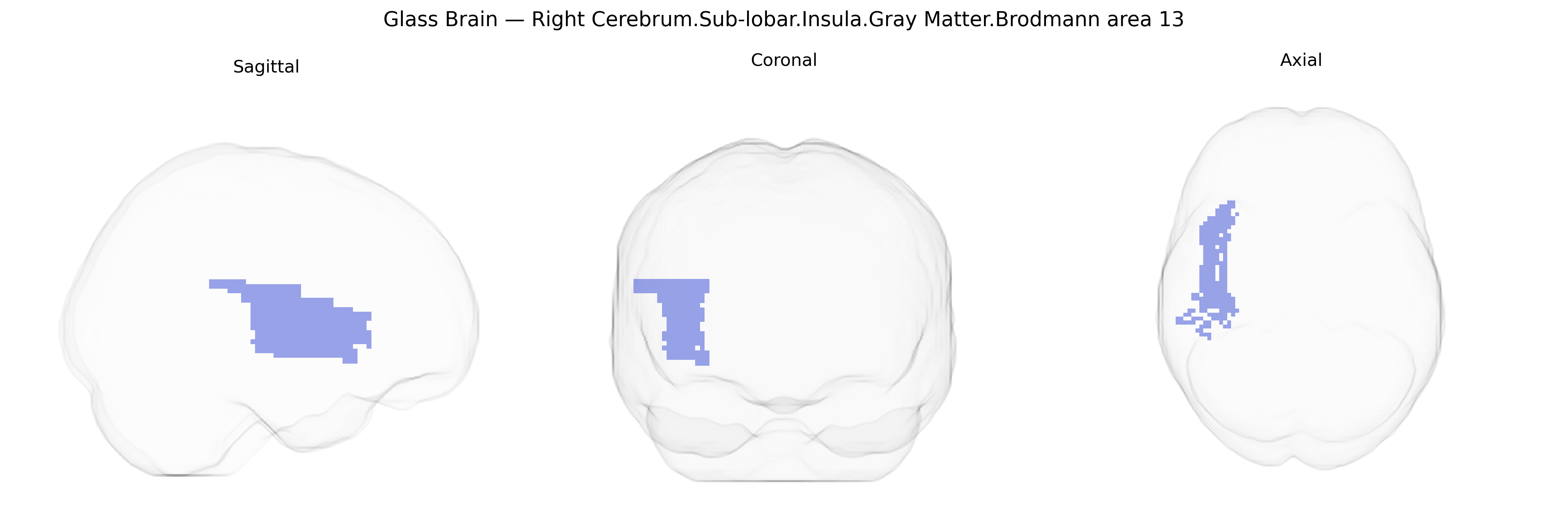 Triplanar Ghost Brain