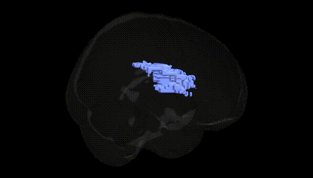 Full Brain Black