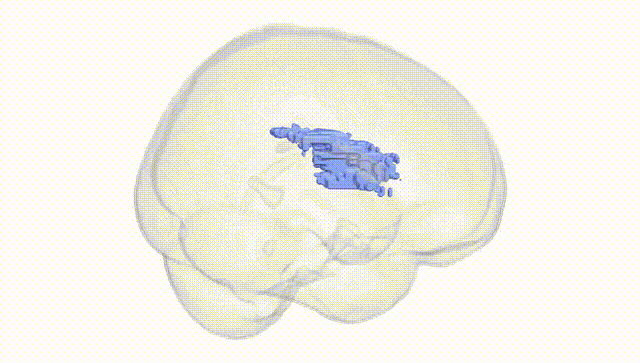 Full Brain White