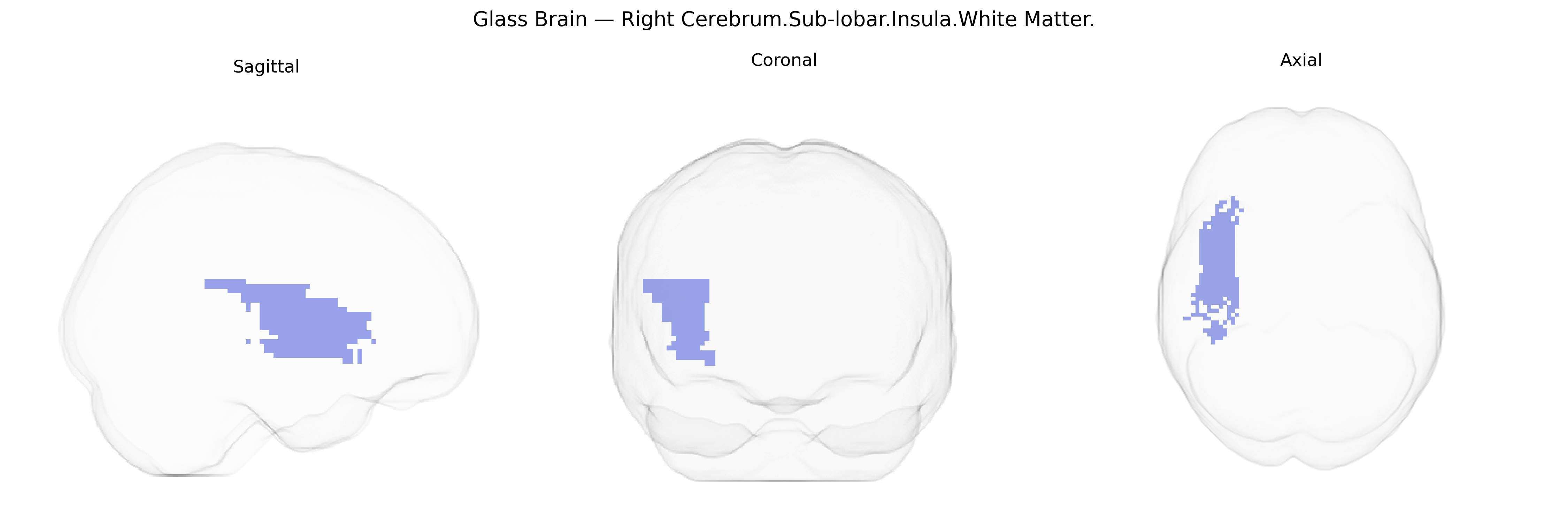 Triplanar Ghost Brain
