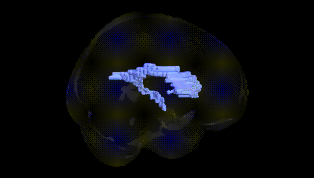 Full Brain Black