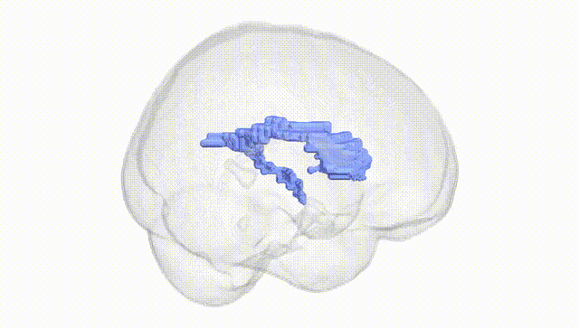 Full Brain White