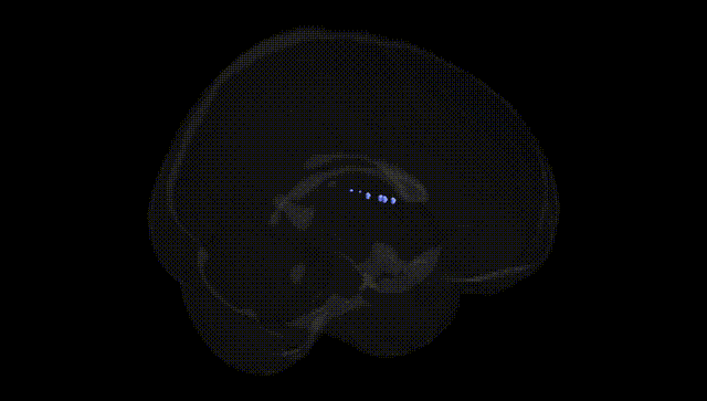 Full Brain Black