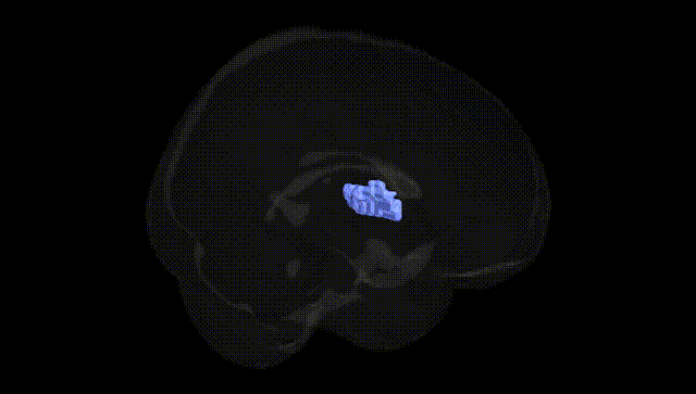 Full Brain Black