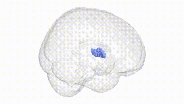 Full Brain White