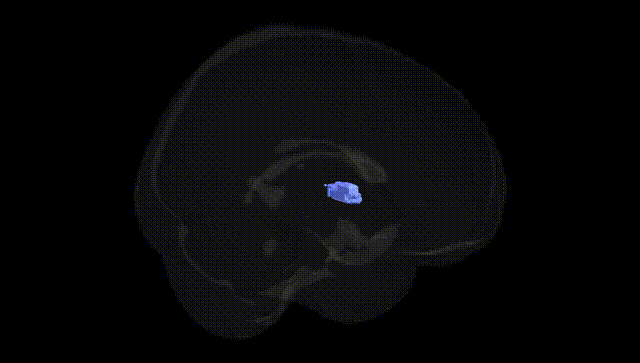 Full Brain Black
