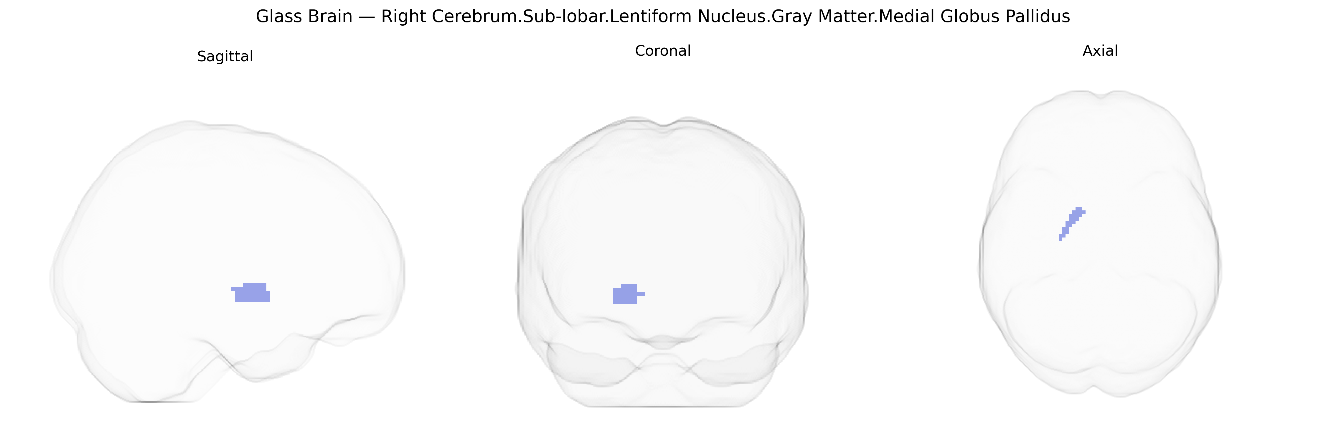 Triplanar Ghost Brain