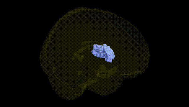 Full Brain Black
