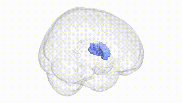 Full Brain White