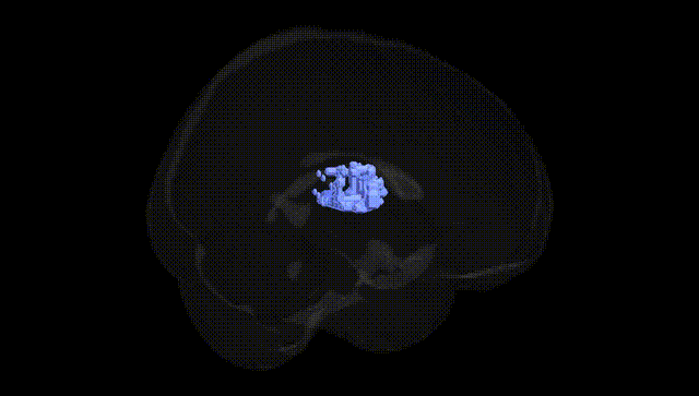 Full Brain Black