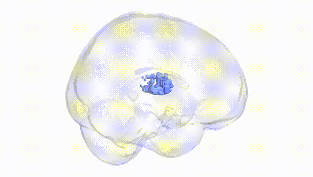 Full Brain White