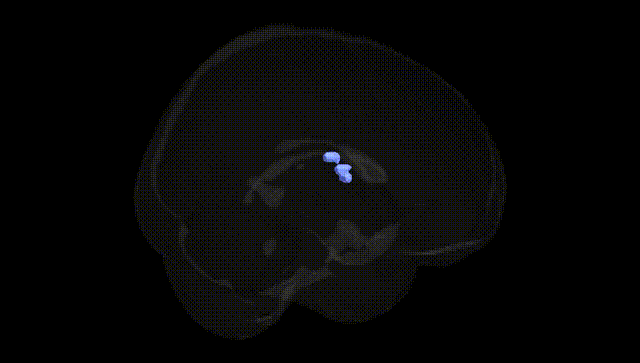 Full Brain Black