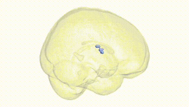 Full Brain White