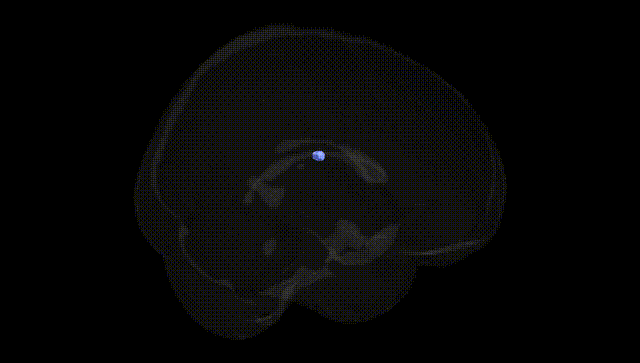 Full Brain Black