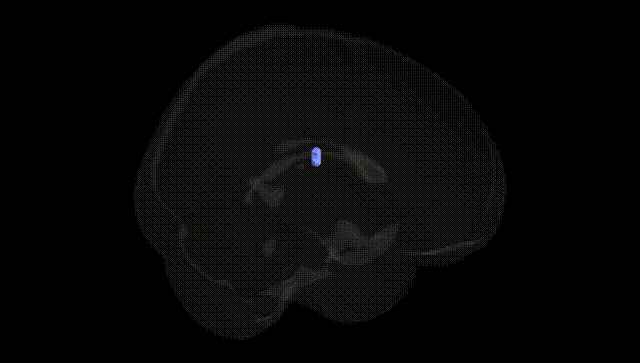 Full Brain Black