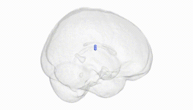 Full Brain White