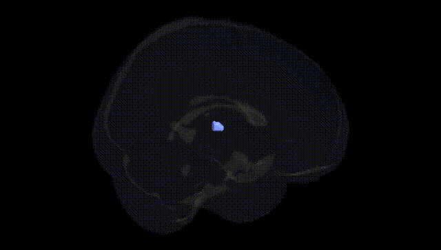 Full Brain Black