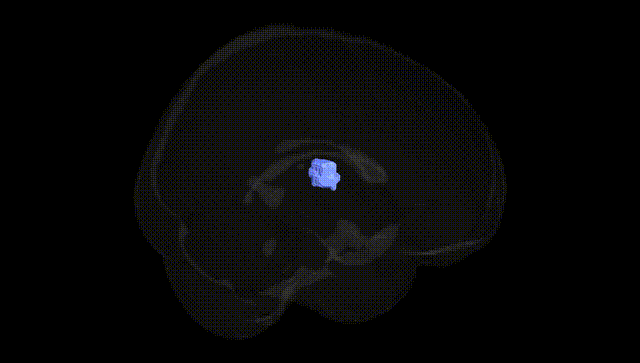 Full Brain Black