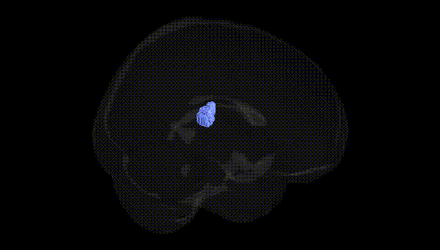 Full Brain Black