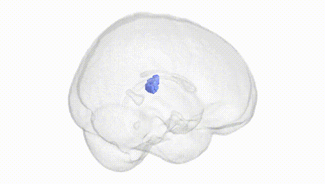 Full Brain White