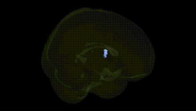 Full Brain Black