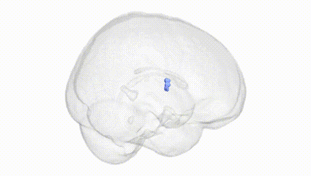Full Brain White