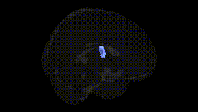 Full Brain Black