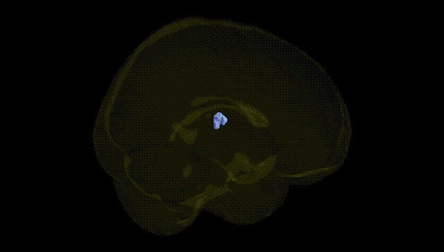 Full Brain Black