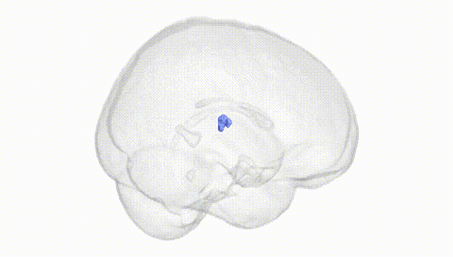 Full Brain White