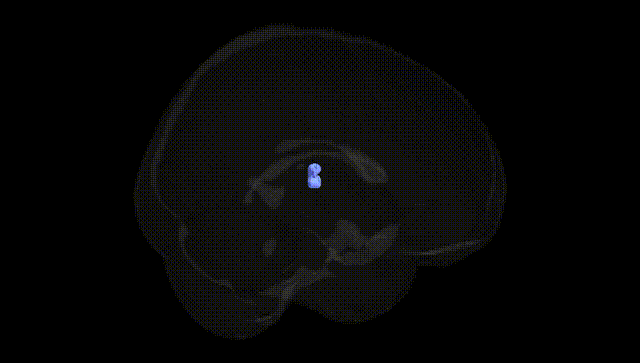 Full Brain Black