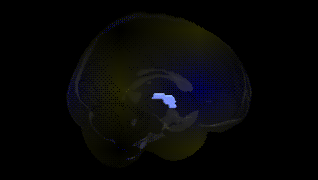 Full Brain Black
