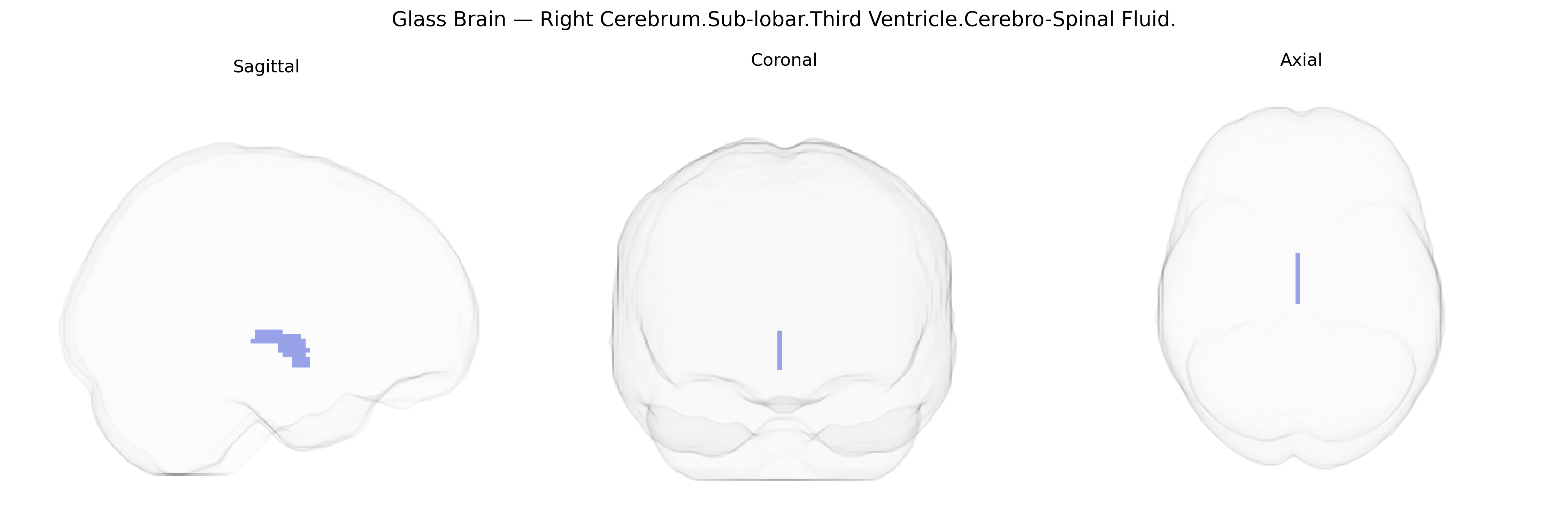 Triplanar Ghost Brain