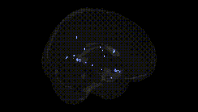 Full Brain Black