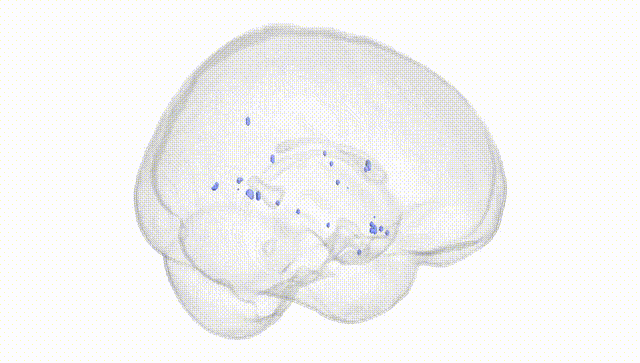 Full Brain White
