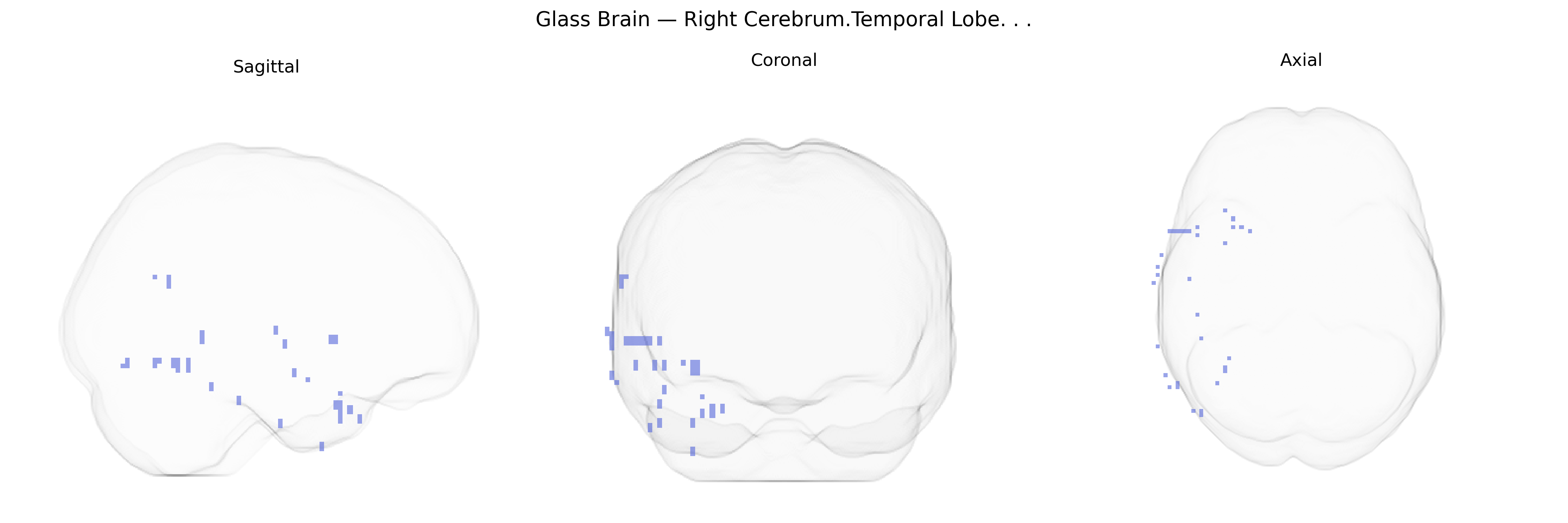 Triplanar Ghost Brain