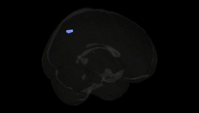 Full Brain Black