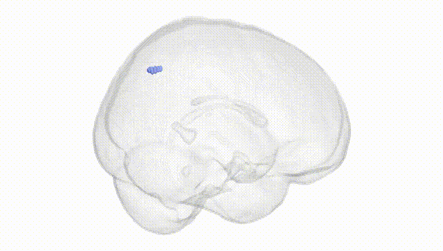 Full Brain White