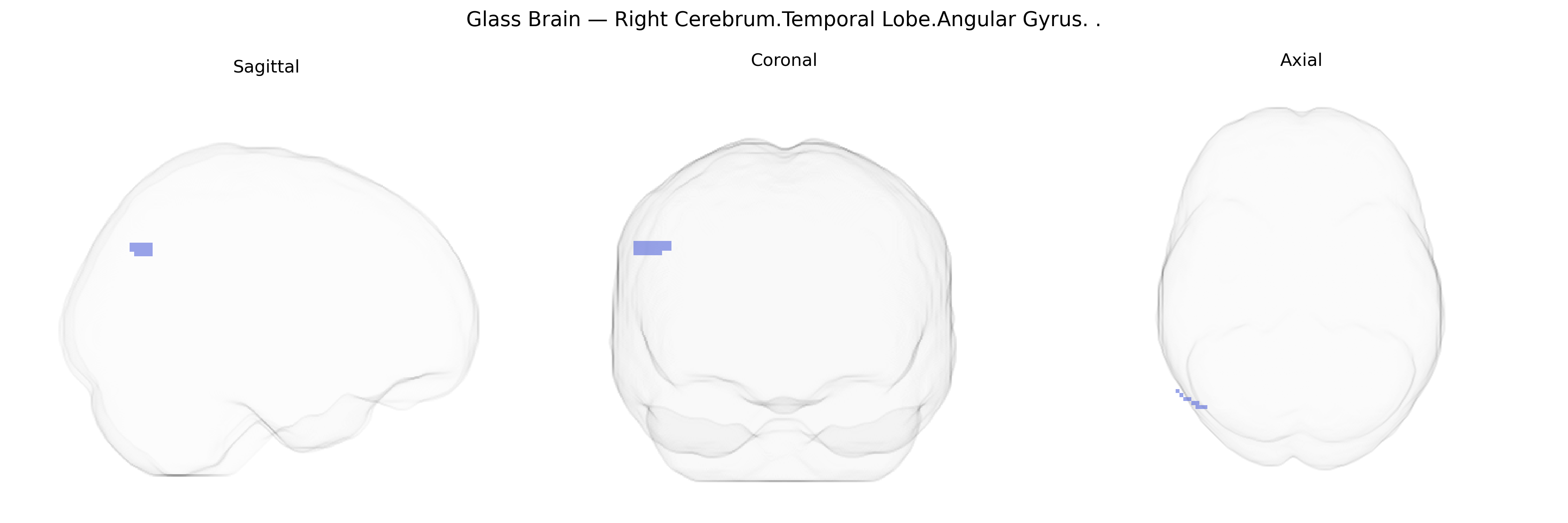 Triplanar Ghost Brain