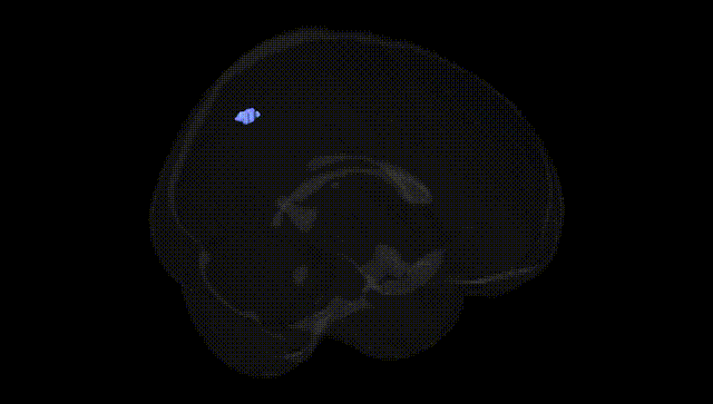 Full Brain Black