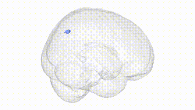 Full Brain White