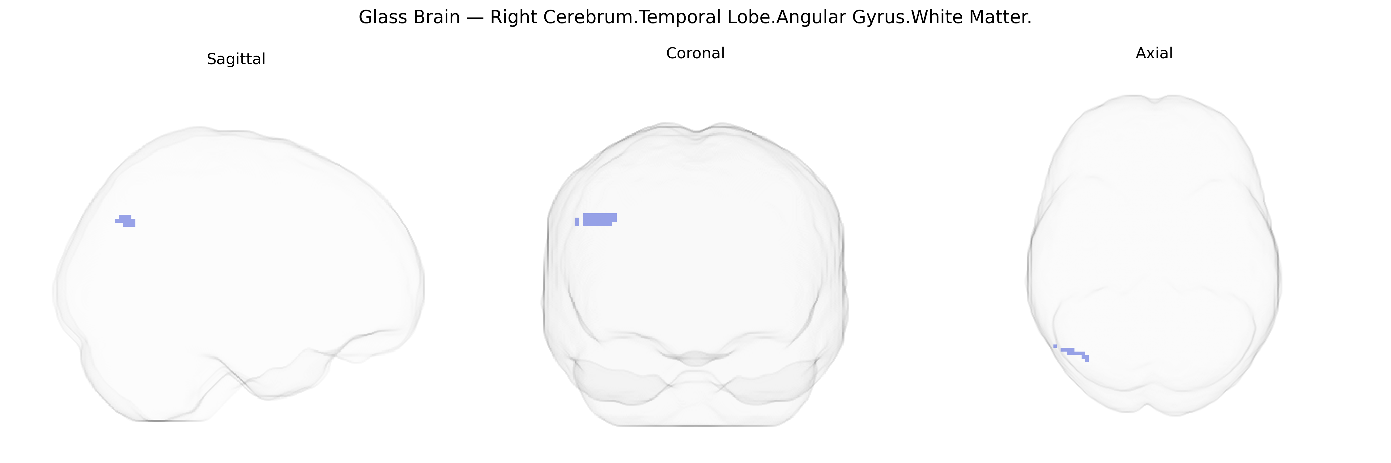 Triplanar Ghost Brain