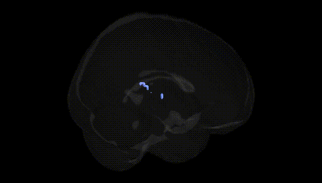 Full Brain Black