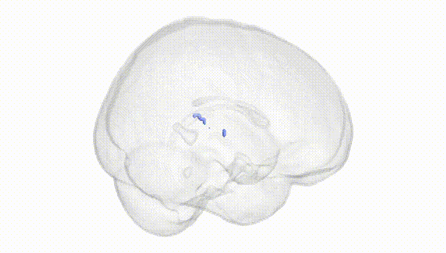 Full Brain White