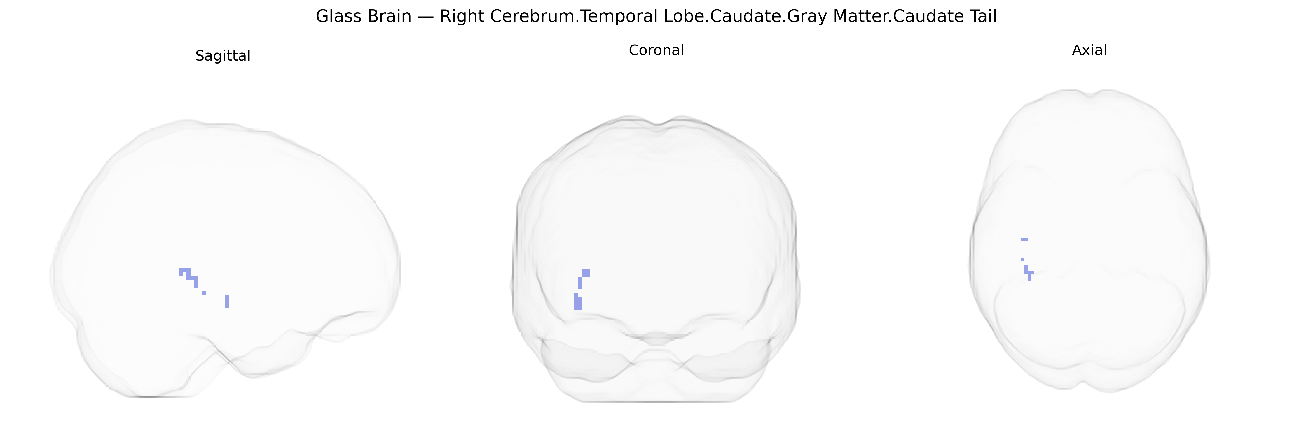 Triplanar Ghost Brain