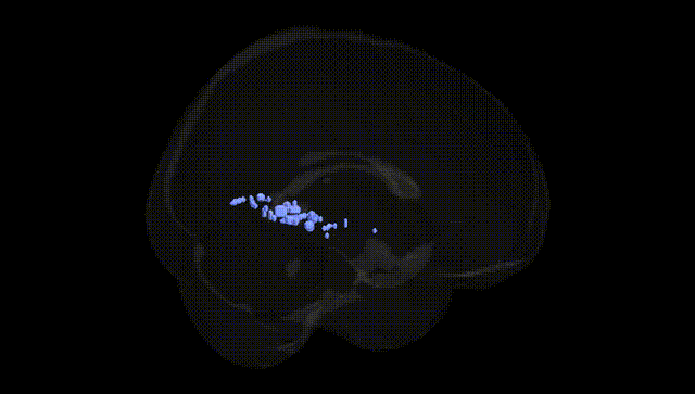 Full Brain Black