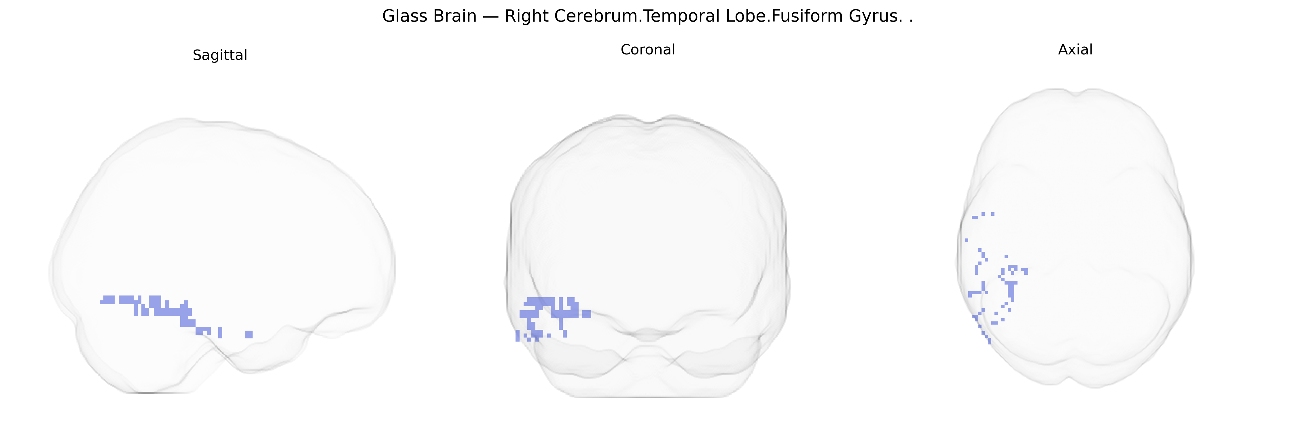 Triplanar Ghost Brain