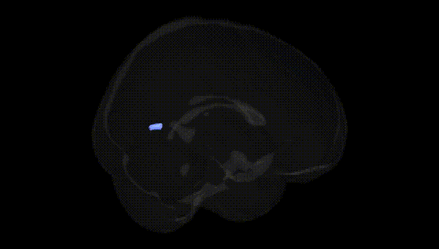 Full Brain Black